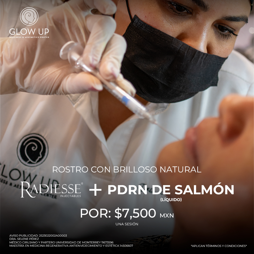 Radiesse + PDRN de Salmón